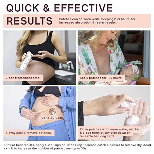 Dermaclara Szilikon Stretch Mark Javítás Kit - Terhesség Biztonságos bőrápolás - Szilikon Heg Lap Szülés utáni Essentials össze